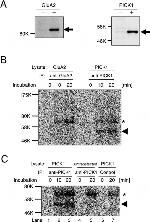 PICK1 Antibody in Western Blot, Immunoprecipitation (WB, IP)