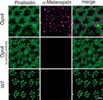 Opsin 4 Antibody in Immunohistochemistry (IHC)