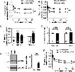 Calpain 2 Antibody in Western Blot (WB)