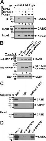 SAP97 Antibody in Western Blot, Immunoprecipitation (WB, IP)