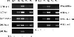 STAT5 beta Antibody in ChIP Assay (ChIP)