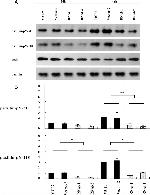 Phospho-Paxillin (Tyr118) Antibody in Western Blot (WB)