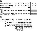 ALK Antibody in Western Blot, Immunoprecipitation (WB, IP)