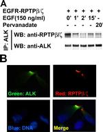 ALK Antibody in Western Blot, Immunocytochemistry, Immunoprecipitation (WB, ICC/IF, IP)