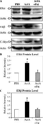 Estrogen Receptor beta Antibody in Western Blot (WB)