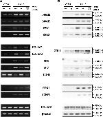 ZEB1 Antibody in Western Blot (WB)