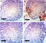 Caspase 3 Antibody in Immunohistochemistry (IHC)