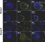 Occludin Antibody in Immunohistochemistry (IHC)