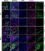 Vimentin Antibody in Immunohistochemistry (IHC)