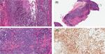 DUX4 Antibody in Immunohistochemistry (IHC)