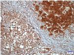 CYP4A11 Antibody in Immunohistochemistry (IHC)