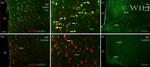 TRH Antibody in Immunohistochemistry (IHC)