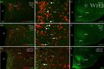 TRH Antibody in Immunohistochemistry (IHC)