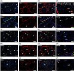 alpha Catenin Antibody in Immunohistochemistry (IHC)