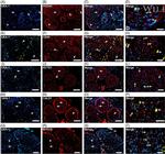 MYO10 Antibody in Immunohistochemistry (Frozen) (IHC (F))