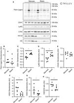 CD41 Antibody in Western Blot (WB)