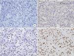 EZH2 Antibody in Immunohistochemistry (Paraffin) (IHC (P))