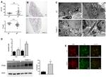 KDEL Antibody in Immunohistochemistry (IHC)