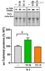 Acetyl-alpha Tubulin (Lys40) Antibody in Western Blot (WB)