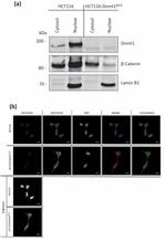 beta Catenin Antibody in Western Blot, Immunocytochemistry (WB, ICC/IF)