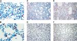 SFTPC Antibody in Immunohistochemistry (IHC)