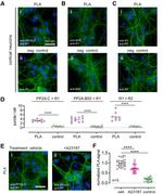 PPP2R2A Antibody in Proximity Ligation Assay (PLA) (PLA)