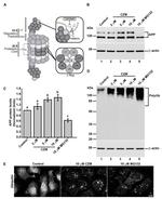 beta Amyloid Antibody in Western Blot (WB)