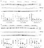 SQSTM1 Antibody in Western Blot (WB)