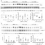 SQSTM1 Antibody in Western Blot (WB)