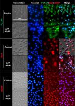 BDNF Antibody in Immunocytochemistry (ICC/IF)