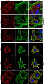 beta Tubulin Antibody in Immunocytochemistry (ICC/IF)