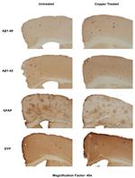 beta Amyloid (1-42) Antibody in Immunohistochemistry (PFA fixed) (IHC (PFA))