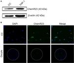 CMKLR1 Antibody in Immunocytochemistry (ICC/IF)