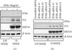 Involucrin Antibody in Western Blot (WB)