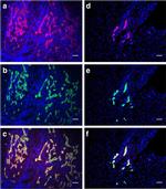 Cytokeratin 19 Antibody in Immunocytochemistry, Immunohistochemistry (ICC/IF, IHC)