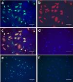 Cytokeratin 19 Antibody in Immunocytochemistry (ICC/IF)