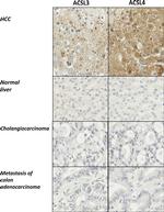 ACSL3 Antibody in Immunohistochemistry (IHC)