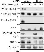 Phospho-p53 (Thr18) Antibody in Western Blot (WB)