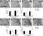 beta Amyloid Antibody in Immunohistochemistry (IHC)