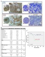 SOX2 Antibody in Immunohistochemistry (IHC)