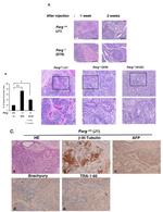 AFP Antibody in Immunohistochemistry (IHC)