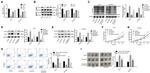 O-linked N-acetylglucosamine (O-GlcNAc) Antibody in Western Blot (WB)