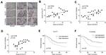 O-linked N-acetylglucosamine (O-GlcNAc) Antibody in Immunohistochemistry (IHC)