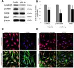 CaMKII alpha Antibody in Immunocytochemistry (ICC/IF)