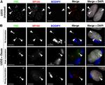 SP100 Antibody in Immunocytochemistry (ICC/IF)