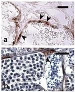 OCT4 Antibody in Immunohistochemistry (IHC)