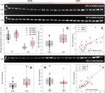 AGL Antibody in Western Blot (WB)