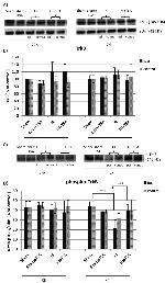 Phospho-TrkB (Tyr516) Antibody in Western Blot (WB)