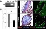 Cardiac Troponin T Antibody in Immunohistochemistry (IHC)