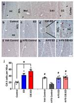 Carbonic Anhydrase II Antibody in Immunohistochemistry (IHC)